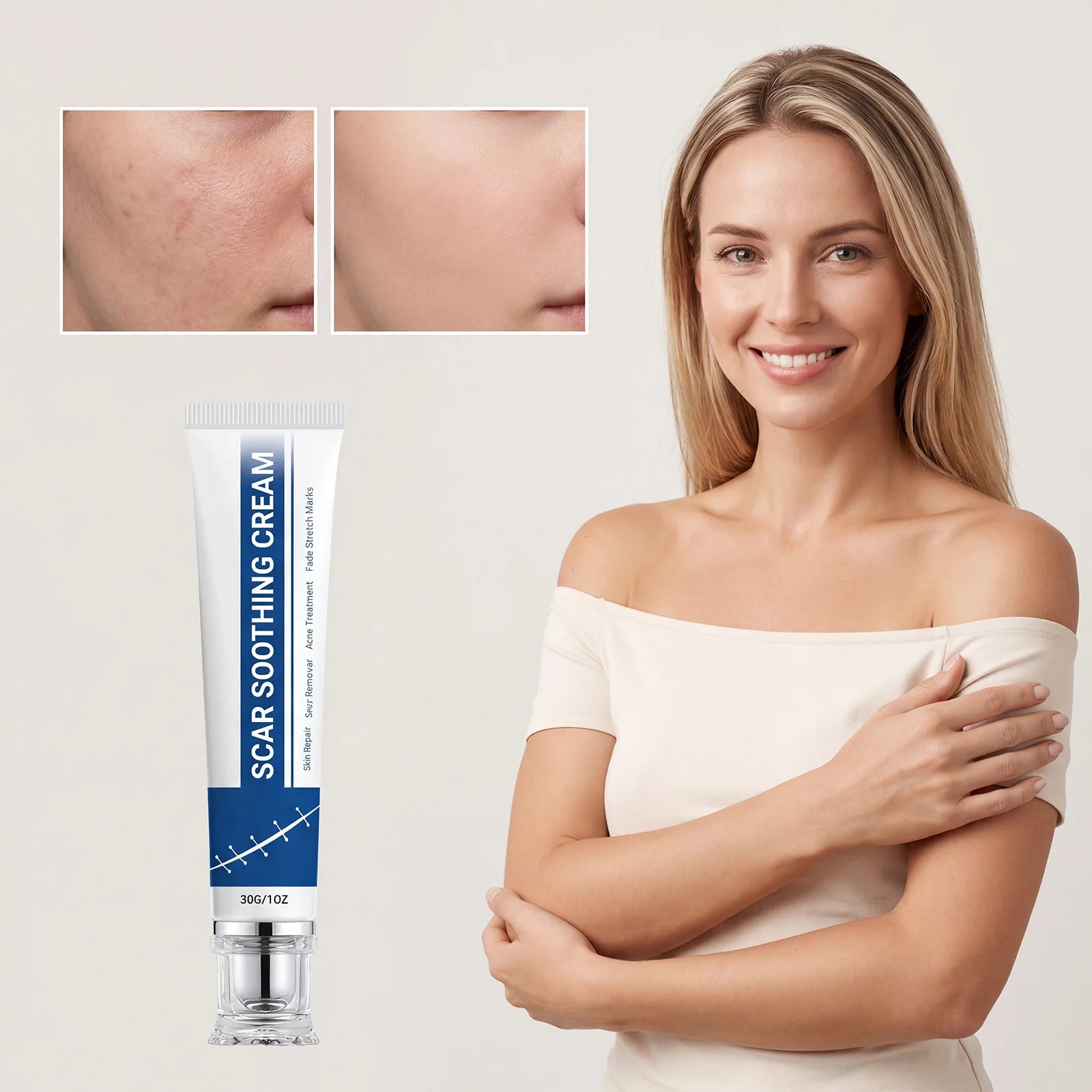 Soothing Scar Cream Lightweight Relieve Redness Tightness Hydrating Nourish Skin Improve Uneven Tone Soothe Dry Itchy Skin